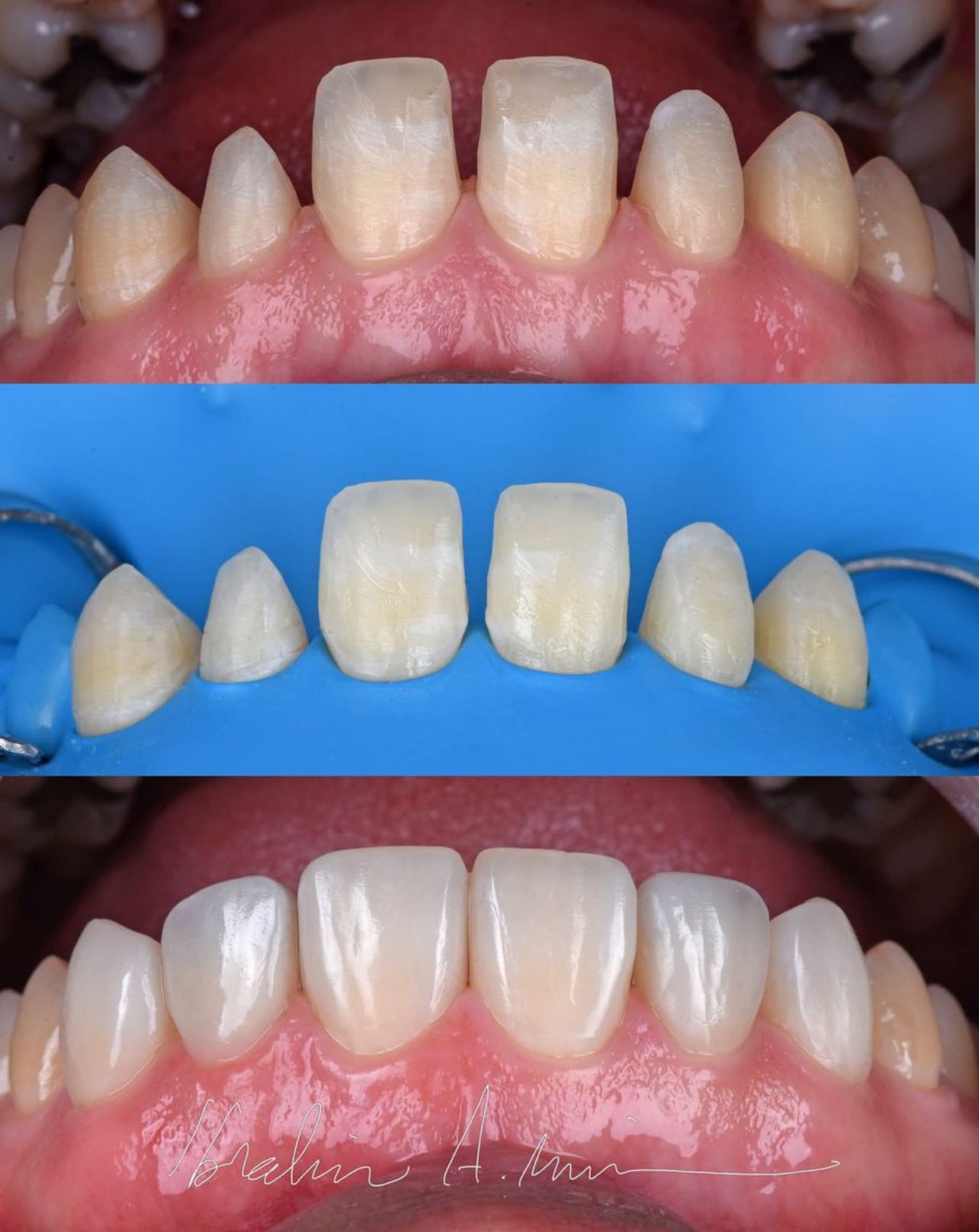 Dental case before and after