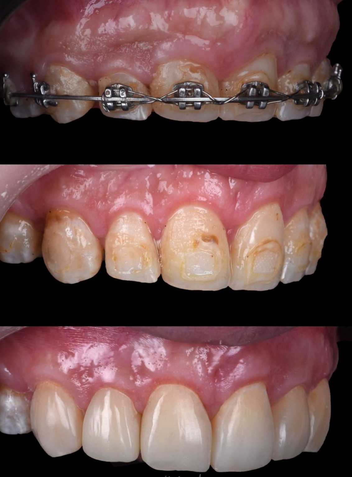 Dental case before and after