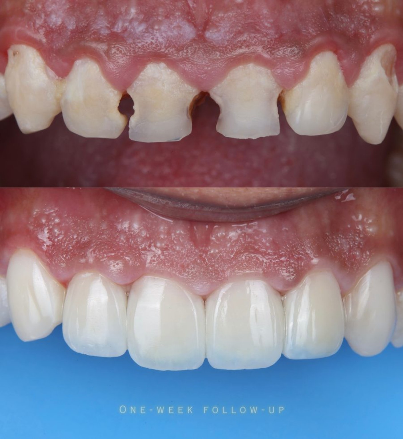 Dental case before and after