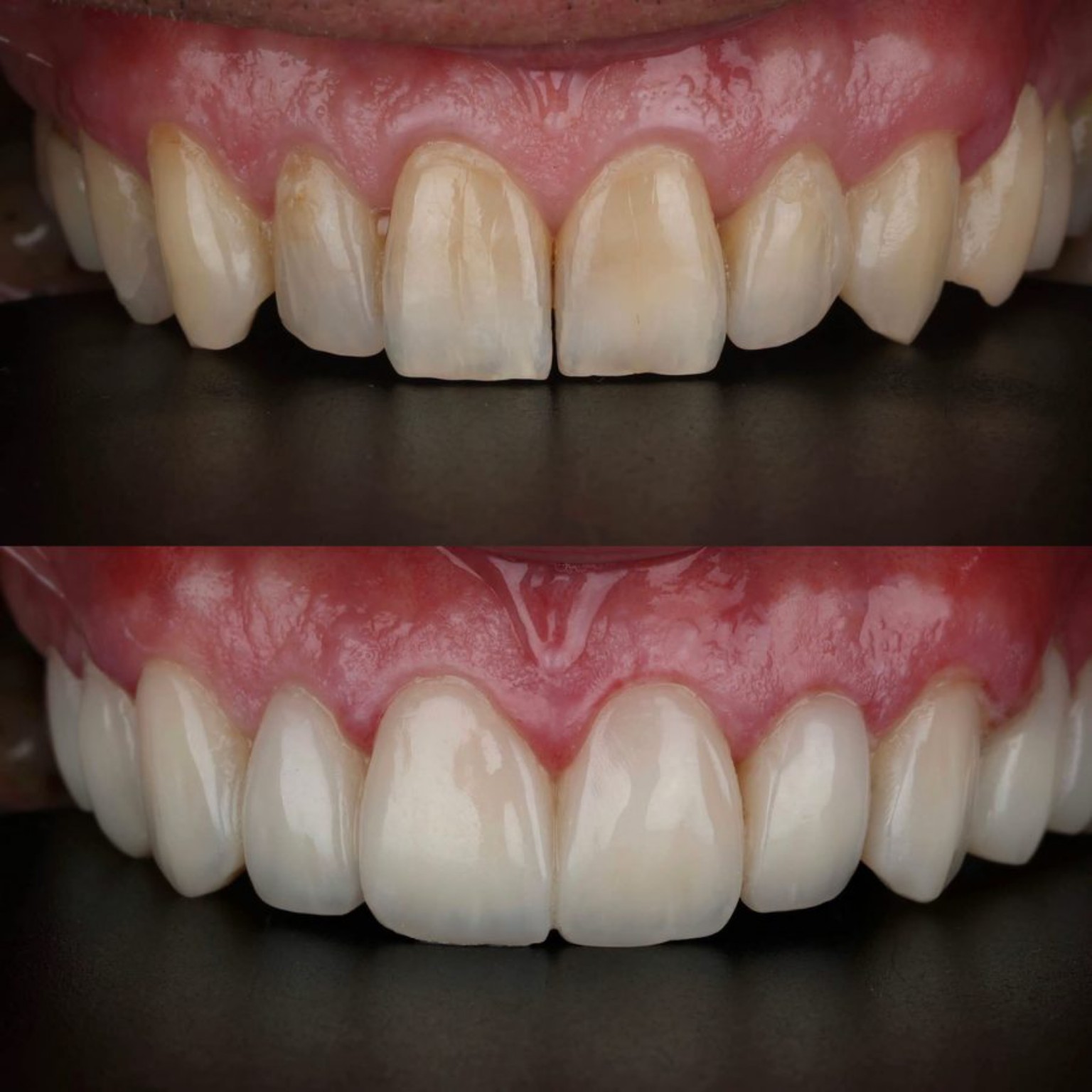 Dental case before and after