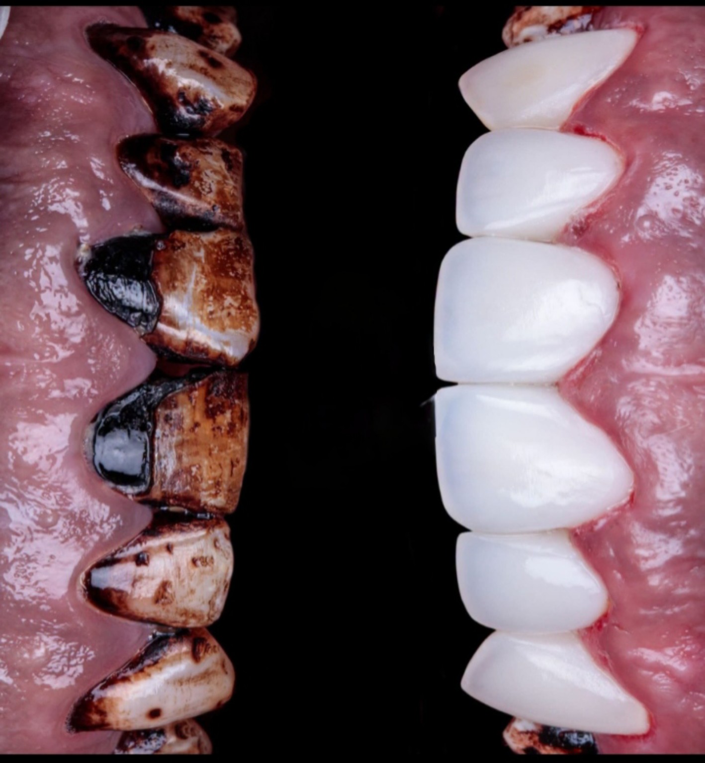 Dental case before and after