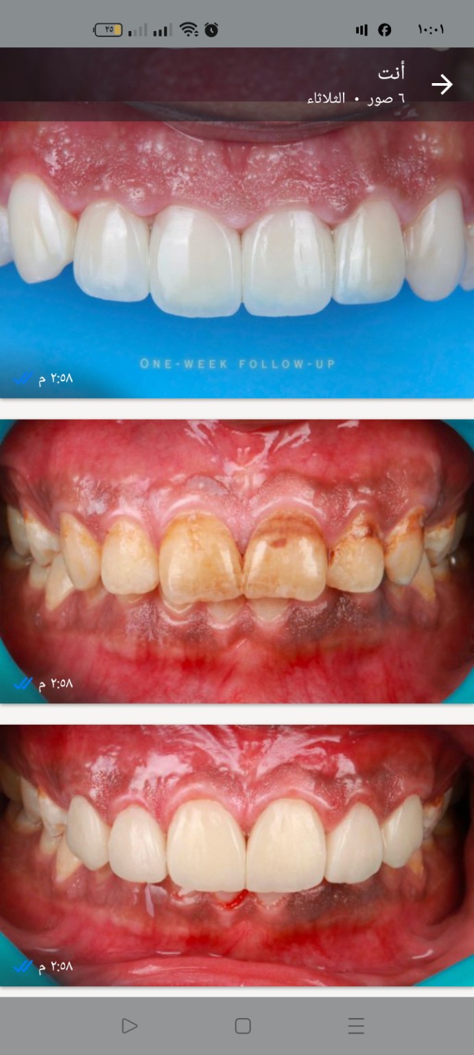Dental case before and after
