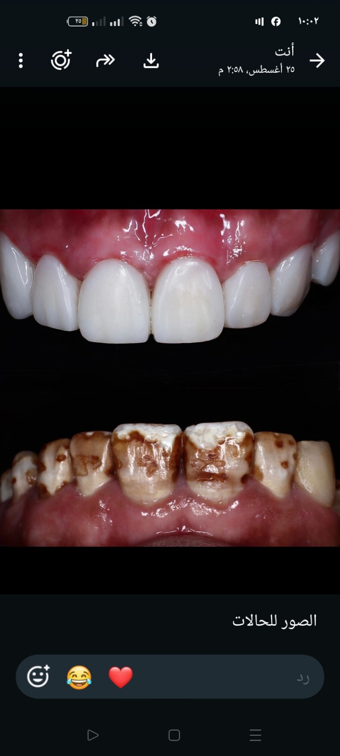 Dental case before and after