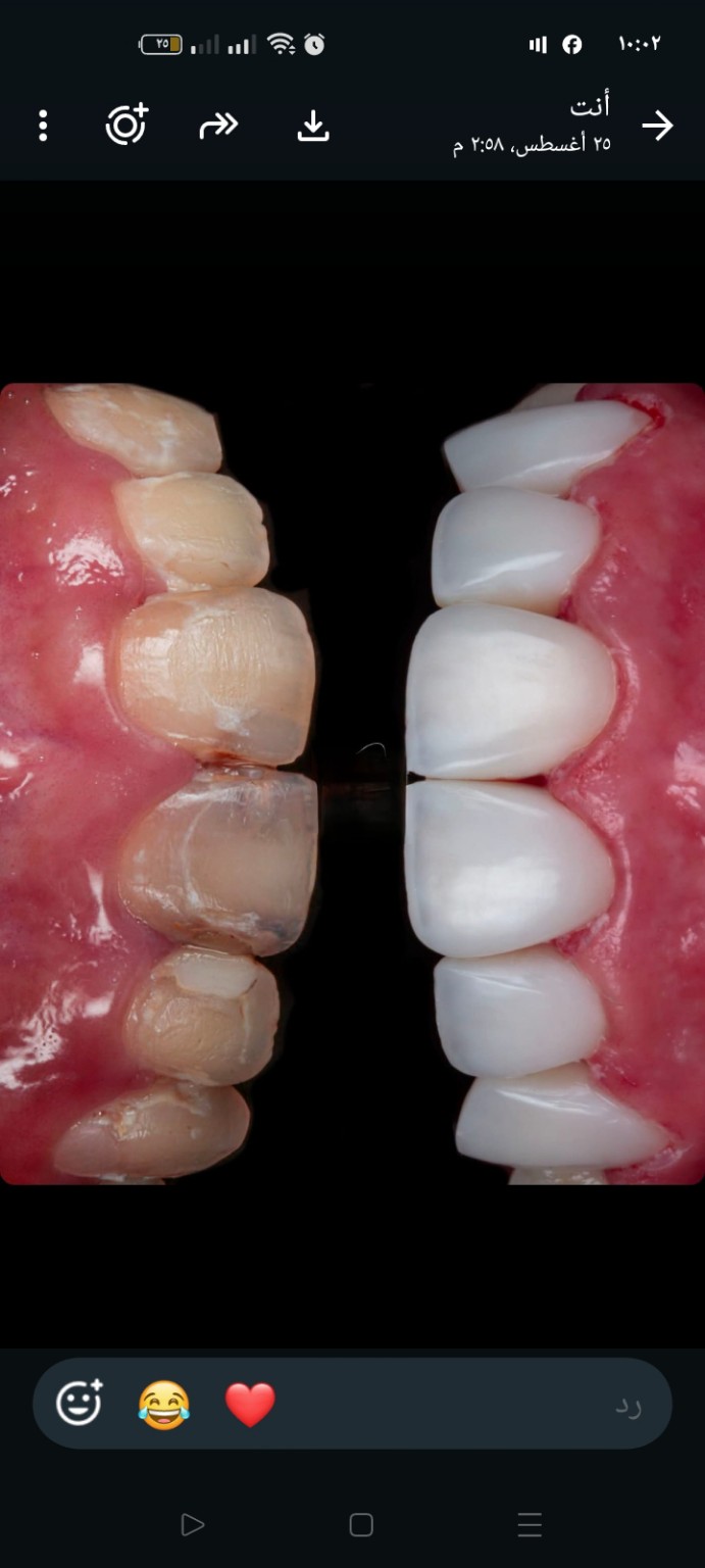 Dental case before and after